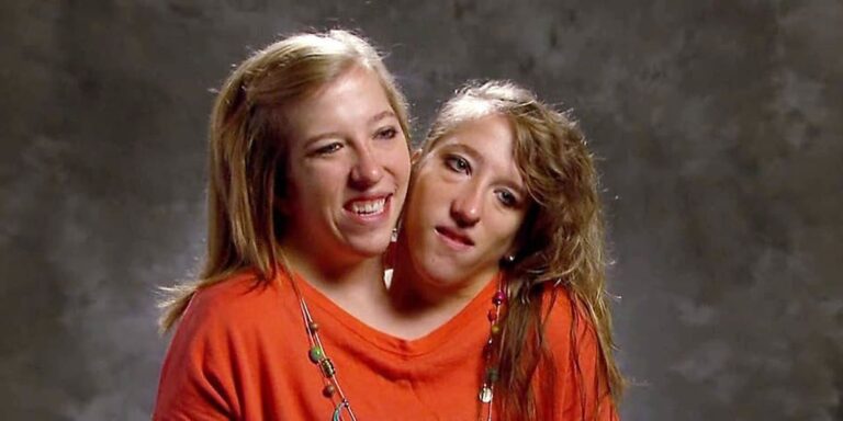 abby and brittany hensel